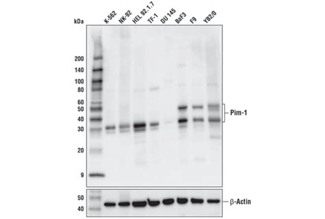 PIM-1 kinases promote prostate cancer growth. A, LNCaP cells were ...
