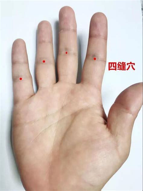 四缝的准确位置图图片 四缝的准确位置图图片