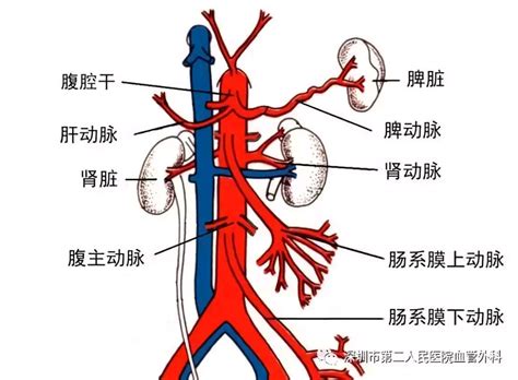 腹腔干血管解剖图图片