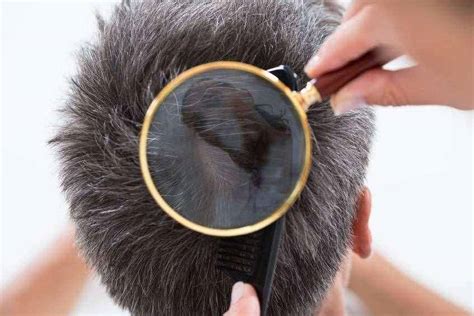 拔一根白头发真的会长十根吗，不及时治疗就会(长白发的4大原因) — 久久经验网