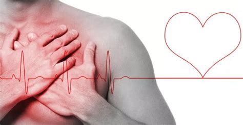 冠状动脉堵塞65%伴有非典型心绞痛怎么办？涂秀华挂号_凤凰网视频_凤凰网