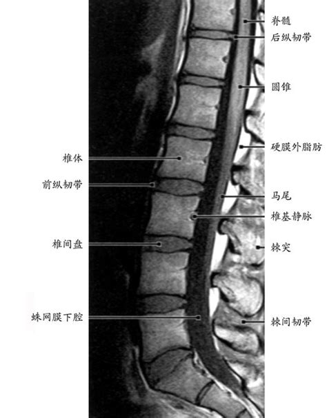 腰椎构造图解图片