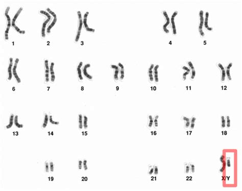 从人类的染色体图谱上看.在性染色体中.Y染色体与X染色体在形态上的主要区别是( ) A.Y染色体较小.X染色体较大B.X染色体较小.Y染色体 ...