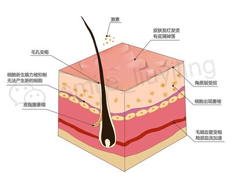皮肤组织结构图图片