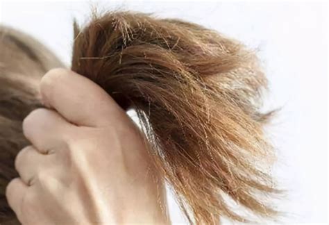 头发容易断又爱掉头发是什么原因？_凤凰网