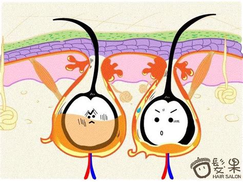 脱发人士福音！科学家发现刺激头发生长新信号分子