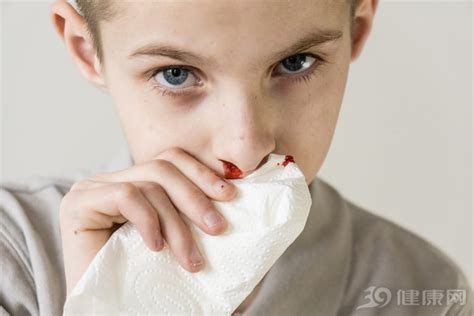 流鼻血如何正确止血？四个方法帮助你快速止血_TOM母婴