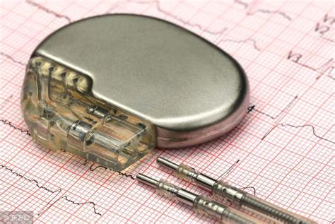 华人科学家新成果：心脏起搏器无需电池，利用心跳自发电 – 肽度TIMEDOO