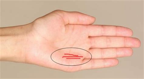 手指弯曲是什么原因造成的？ - 知乎