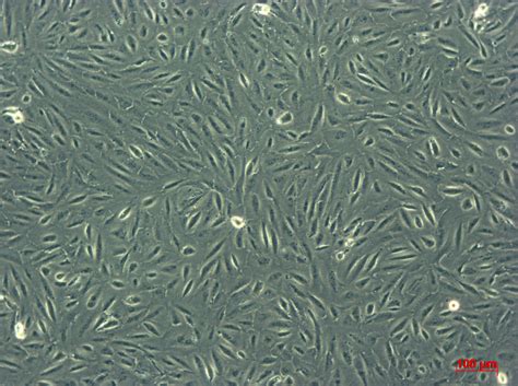 MG-63细胞ATCC CRL-1427细胞 MG63人骨肉瘤细胞株购买价格、培养基、培养条件、细胞图片、特征等基本信息_生物风