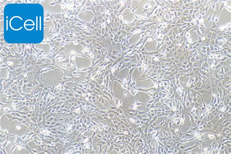 4T1细胞ATCC CRL-2539细胞 小鼠乳腺癌细胞株购买价格、培养基、培养条件、细胞图片、特征等基本信息_生物风