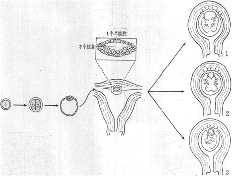 图18～37 单合子的单卵双胎-功能组织学与胚胎学-医学