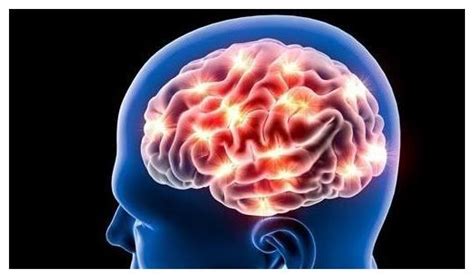 专家提醒：脑梗的“祸根”找到了，以下4个症状出现一个早做检查__财经头条