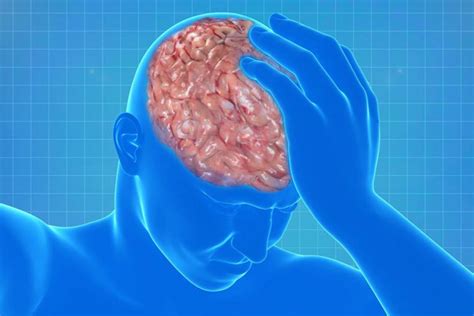 脑梗塞和脑血栓是一样吗-脑梗塞诊断-复禾健康