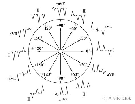 心电轴的测量方法及意义_挂云帆
