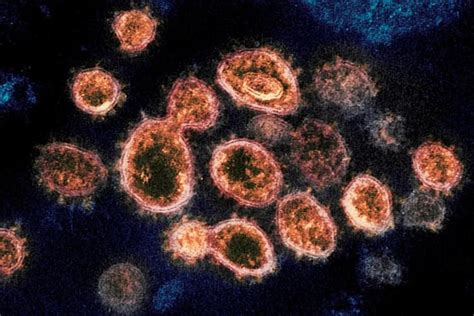 世界上最恐怖的十大病毒：埃博拉病毒致死率高达90%-飞扬号