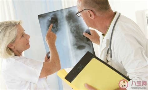 低剂量CT体检是早期发现肺癌的必要手段_凌源市中心医院