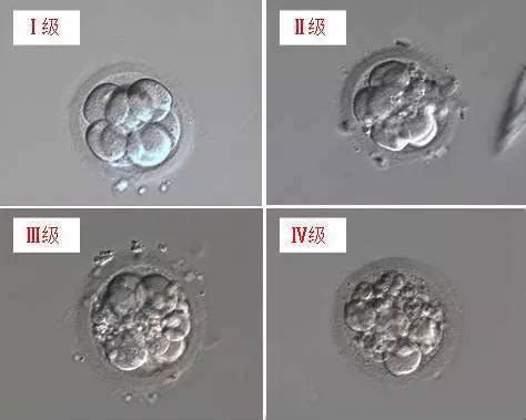 如何评判试管婴儿胚胎的质量？有标准吗？ - 知乎