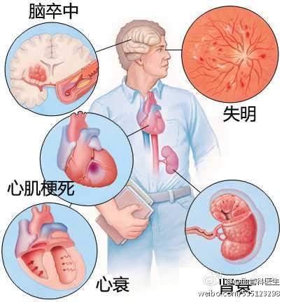 高血压的6个并发症，你都知道吗？_上海中医医院
