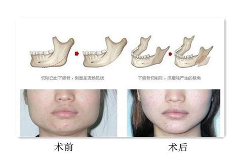 下颚在哪个位置图图片 下颚在哪个位置图图片