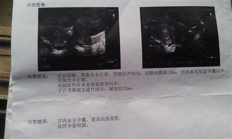 孕期同房姿势图：图片展示怀孕期间正确同房图！_手机凤凰网
