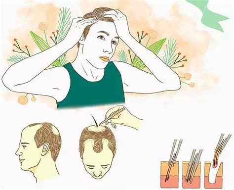 每天掉多少根头发属于正常范围？ - 知乎