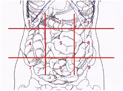 腹部分区：判断腹痛原因