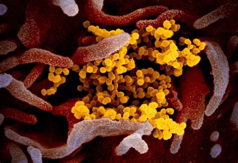 新冠病毒“高清彩照”：一组图看清它显微镜下的真面目_手机新浪网