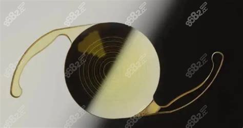 美国爱尔康人工晶体价格查询:单焦|双焦|三焦晶体价格2600/片,近视眼矫正-8682整形网