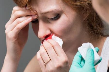鼻子出血是什么原因？这五个原因引发及时改善治疗-【吾爱女性网】