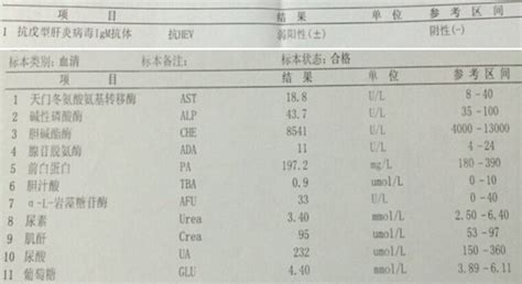 IgM和IgG检测结果应当如何解读？一篇文章全讲透了_澎湃号·政务_澎湃新闻-The Paper