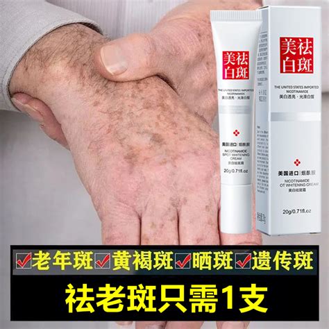 去斑霜正品祛斑手上脸上老年斑强力去除老人斑专用药除老年黑班部-淘宝网