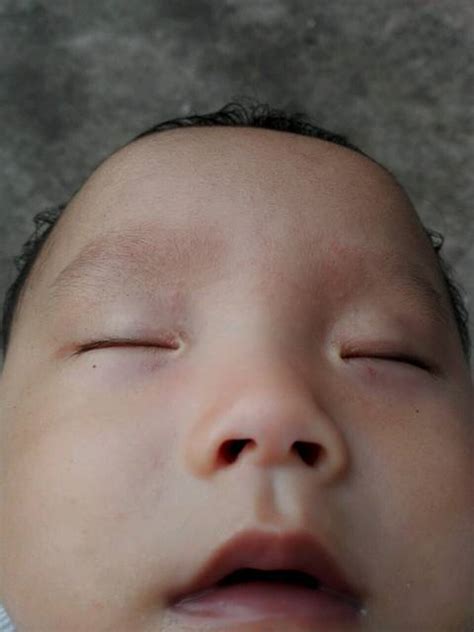 一个月宝宝额头上长了好多小颗粒_婴儿头顶软包正常图片 - 随意云