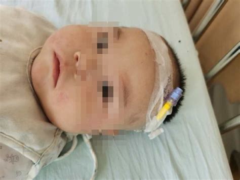 看苏州：5个月大的宝宝得了湿疹差点毁容！@宝妈们，这些事儿别大意-媒体聚焦-苏州科技城医院