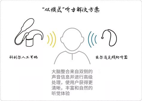 “助听器+人工耳蜗”，原来这样登对！ - 品牌新闻 - 中国助听器行业网