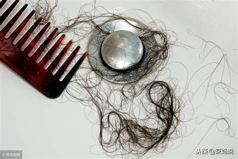 油性头发脱发怎么办（头发油、头屑多、掉发怎么办？这6种方法能改善，还不快收藏起来） | 说明书网