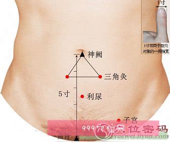 痛经应该怎么办？