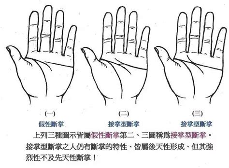 gth断掌事件图片