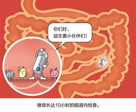贲门的位置图图片