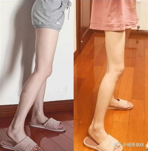 怎么瘦腿最快最有效 揭秘女生瘦腿的最快方法_凤凰资讯