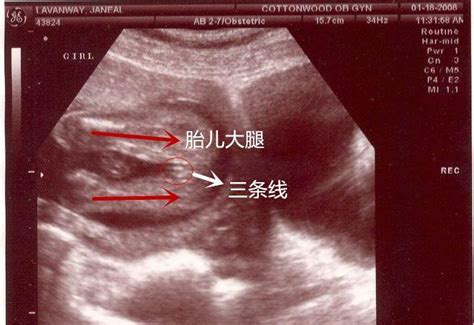 b超图图片