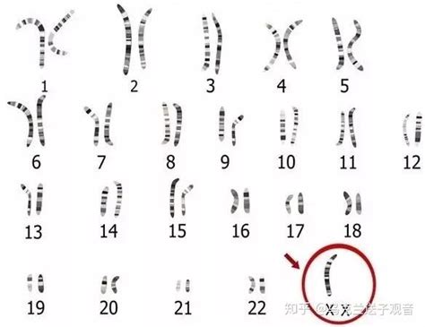 关于人类染色体核型报告解读及相关案例简述 | LRC - 知乎
