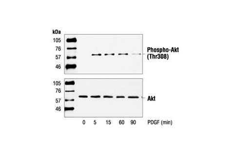 Phospho-Akt (Ser473) Antibody | Cell Signaling Technology