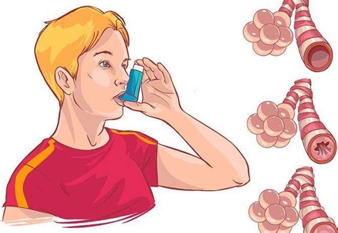 哮喘发作时为什么总感觉喘不过气来？_治疗