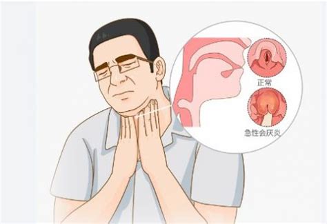 和平日报 | 医疗保健：嗓子疼别大意！警惕可能致命的急性会厌炎