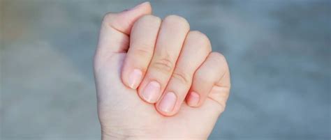 为什么手指甲盖里会长白色月牙？