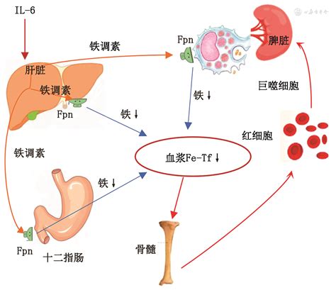 铁缺乏症和缺铁性贫血诊治和预防的多学科专家共识（2022年版） - 中华医学杂志
