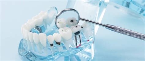 牙齿松动了能恢复吗?这得看牙齿一二三度松动程度如何 牙科行业资讯 - 口腔新资讯 - 牙齿矫正网