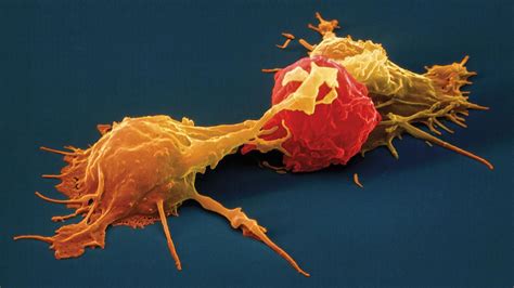 NK细胞疗法,Nature报道:NK细胞是哄癌细胞休眠的高手_全球肿瘤医生网