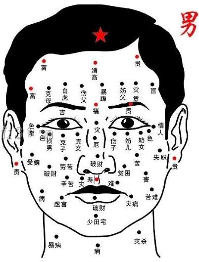 面部痣相图解大全图片 面部痣相图解大全图片